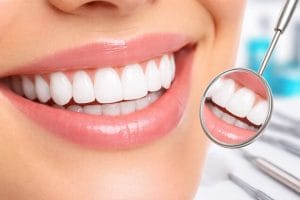 طول عمر کامپوزیت دندان و مراقبت‌های آن