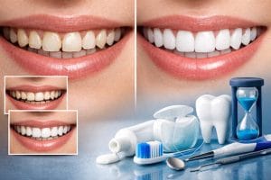 کامپوزیت چیست