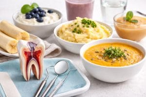 چند ساعت بعد از عصب کشی میتوان غذا خورد - غذاهای نرم مناسب پس از درمان ریشه