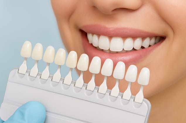 سفیدترین رنگ کامپوزیت دندان BL1 در مقایسه با رنگ طبیعی – کلینیک آرنیک