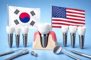 انواع ایمپلنت دندان کره‌ای و آمریکایی در کلینیک آرنیک