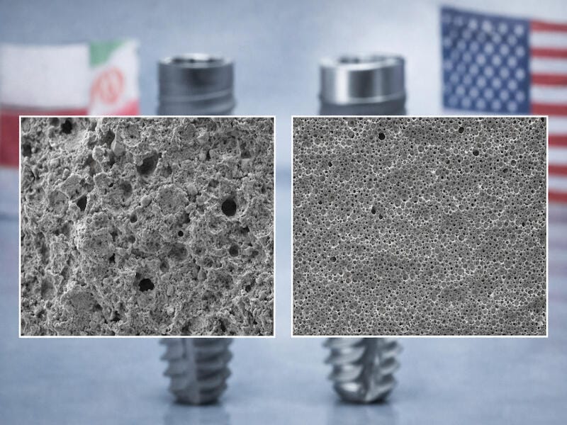 تفاوت کیفیت ایمپلنت ایرانی و خارجی در میکروسکوپ الکترونی