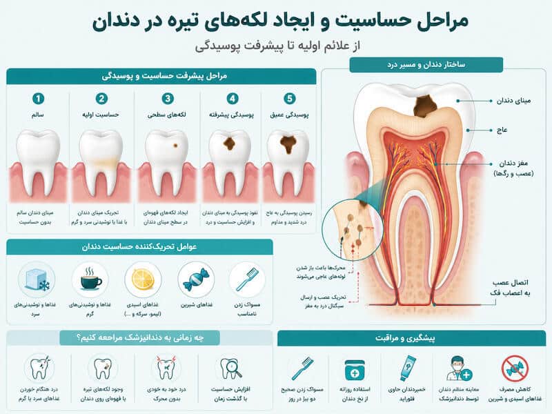 نشانه های پوسیدگی دندان شامل حساسیت درد و لکه روی دندان